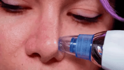 Blackheads™ - Pelle Liscia e Vellutata